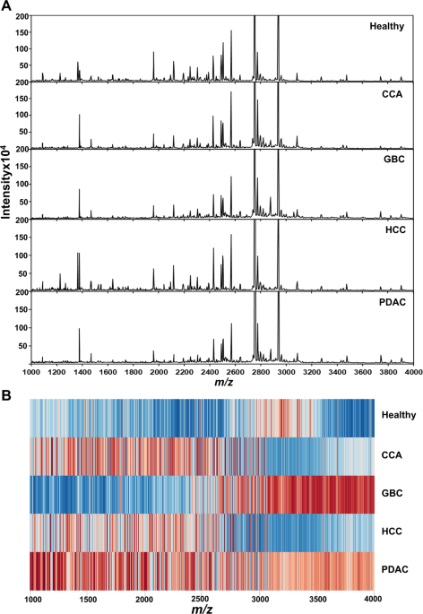 Serum peptide biomarkers by MALDI-TOF MS coupled with machine learning for diagnosis and classification of hepato-pancreato-biliary cancers