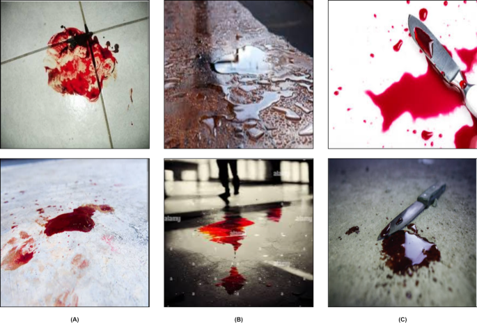 Real time blood detection in CCTV surveillance using attention enhanced InceptionV3