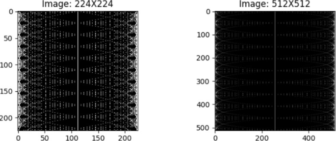 Integrating non-linear radon transformation for diabetic retinopathy grading
