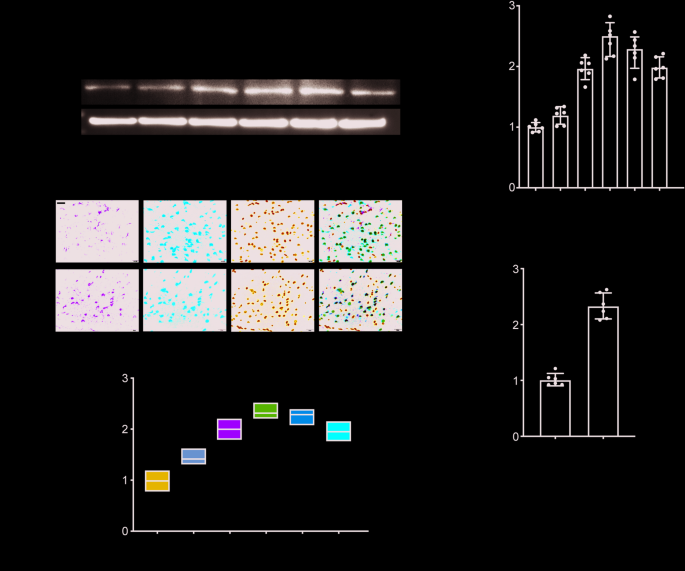 miR-221 activates Sox11 to reduce brain injury after intracerebral hemorrhage via inhibiting neuroinflammation