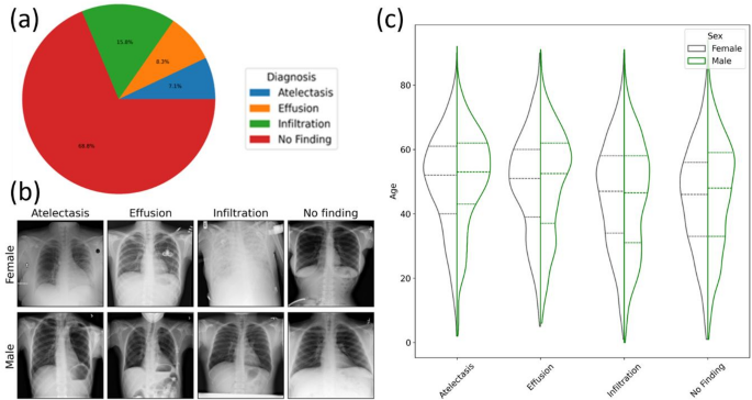 Ethical considerations and robustness of artificial neural networks in medical image analysis under data corruption