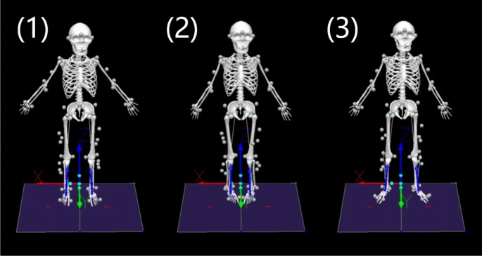 Effects of various static calibration postures on knee mechanics during locomotor tasks using statistical parametric mapping analysis