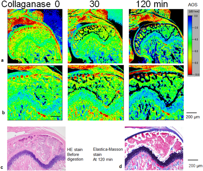 Selective deletion or preservation of tissue components via enzymatic digestion monitored by scanning acoustic microscopy