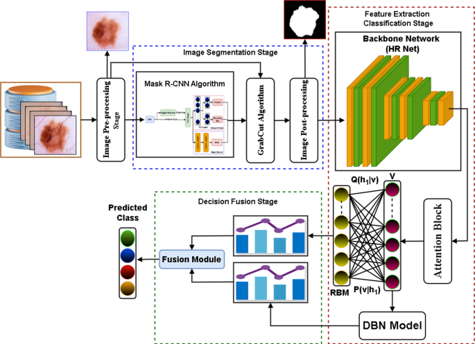 A deep learning framework for automated early diagnosis and classification of skin cancer lesions in dermoscopy images