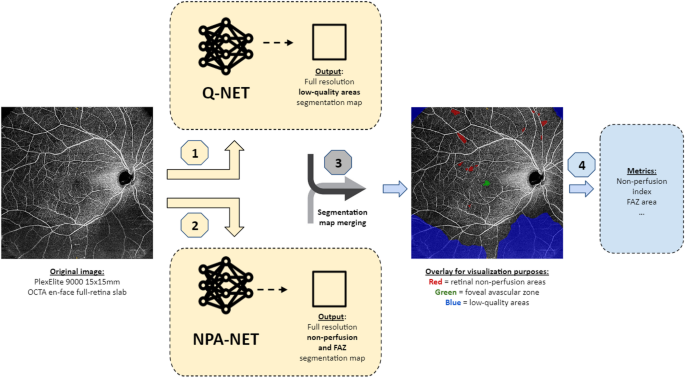 Deep learning for retinal non-perfusion and foveal avascular zone analysis in wide-field OCTA in diabetic retinopathy