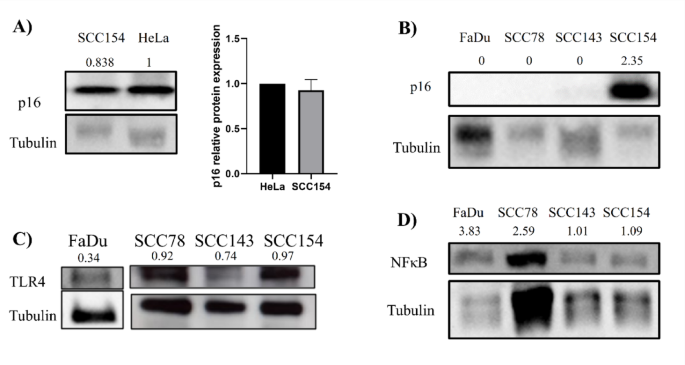 The antitumor effect of tlr4 inhibition in head and neck cancer cell lines