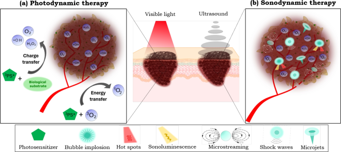 Comparative analysis of ALA mediated sonodynamic therapy considering tumor size, light combination and ultrasound delivery in murine cutaneous melanoma