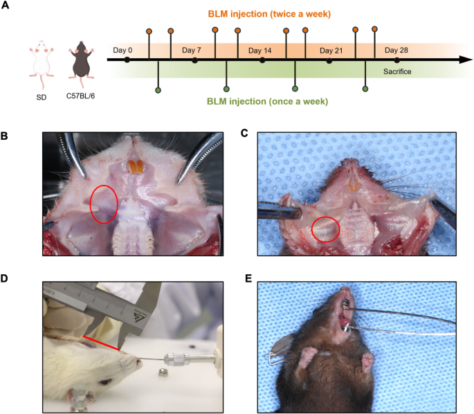 Induction and characterization of oral submucous fibrosis model with different pathological stages in rats and mice