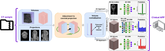 A simple and effective approach for body part recognition on CT scans based on projection estimation