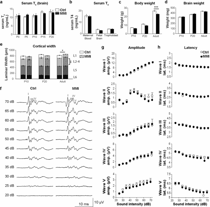 Perinatal methimazole exposure impairs the distribution and function of layer 5 neurons in the mouse auditory cortex