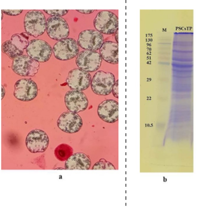 Crude protoscolex antigens of echinococcus granulosus as serological markers for human hydatidosis detection