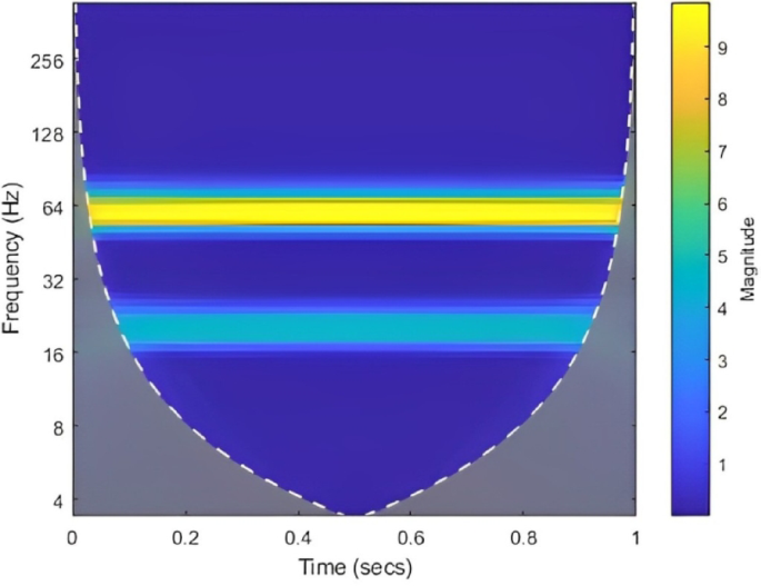 Intelligent islanding detection framework for smart grids using wavelet scalograms and HOG feature fusion