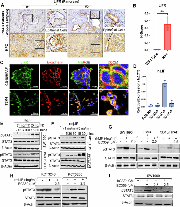 Targeting cancer-associated fibroblast-driven LIF/LIFR axis improves the therapeutic efficacy of gemcitabine and nab-paclitaxel in pancreatic cancer