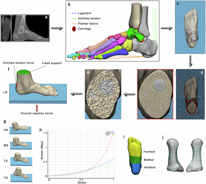 Preserving the first ray or first two rays in forefoot amputation for diabetic foot ulcers