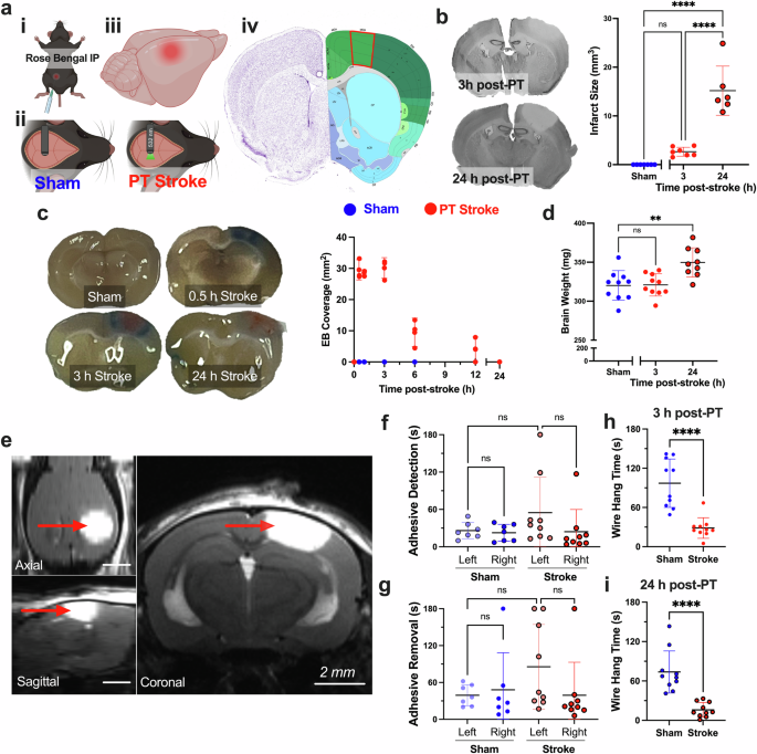 Microglia are prominent producers of inflammatory cytokines during the hyperacute phase of ischemic stroke
