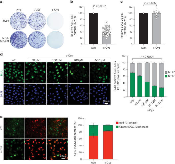 d-cysteine impairs tumour growth by inhibiting cysteine desulfurase NFS1
