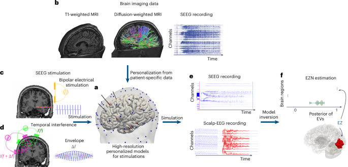 Virtual brain twins for stimulation in epilepsy
