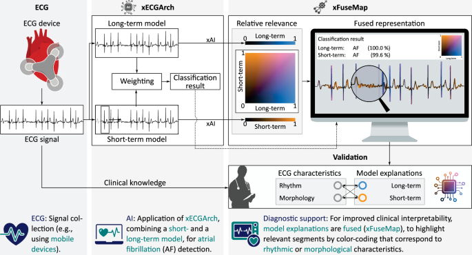Fusion of automatically learned rhythm and morphology features matches diagnostic criteria and enhances AI explainability