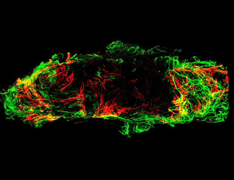 PIEZO1-activated donor lymphatic remodeling integrates with autologous lymphangiogenesis to enhance vein graft patency in mice | Science Translational Medicine