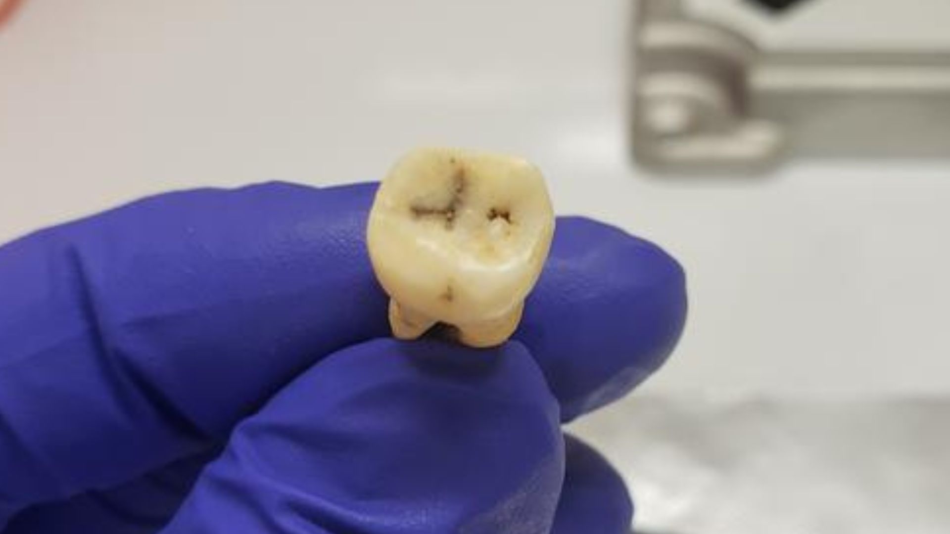 Scientists identify pathogen responsible for ‘world’s first pandemic’