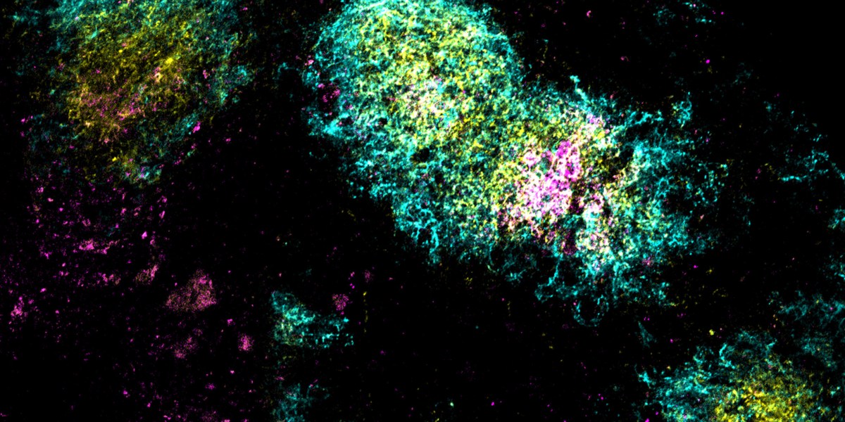 One-shot vaccines for HIV and covid