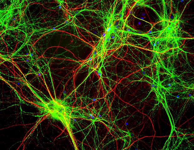 Computational approach provides insight into neural progenitor cells and their role in brain disorders