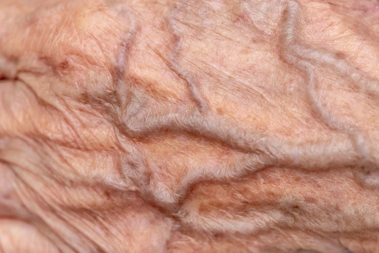 Covid Could Be Quietly Aging Your Arteries by Five Years