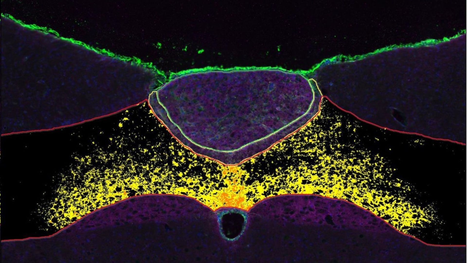 New obesity drug rivals Ozempic without nausea or gut distress