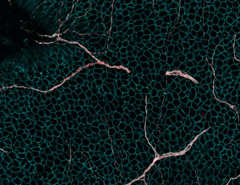 Vagal TRPV1+ sensory neurons protect against influenza virus infection by regulating lung myeloid cell dynamics | Science Immunology