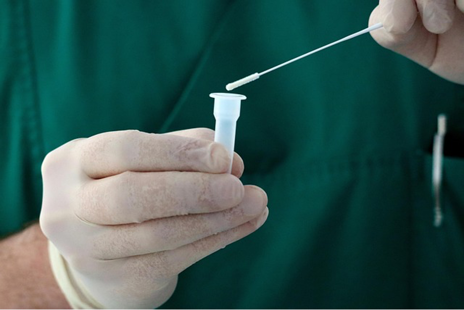 Covid Leads to Accelerated Blood Vessel Aging