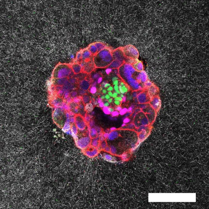The First Real Time View of Human Embryo Implantation