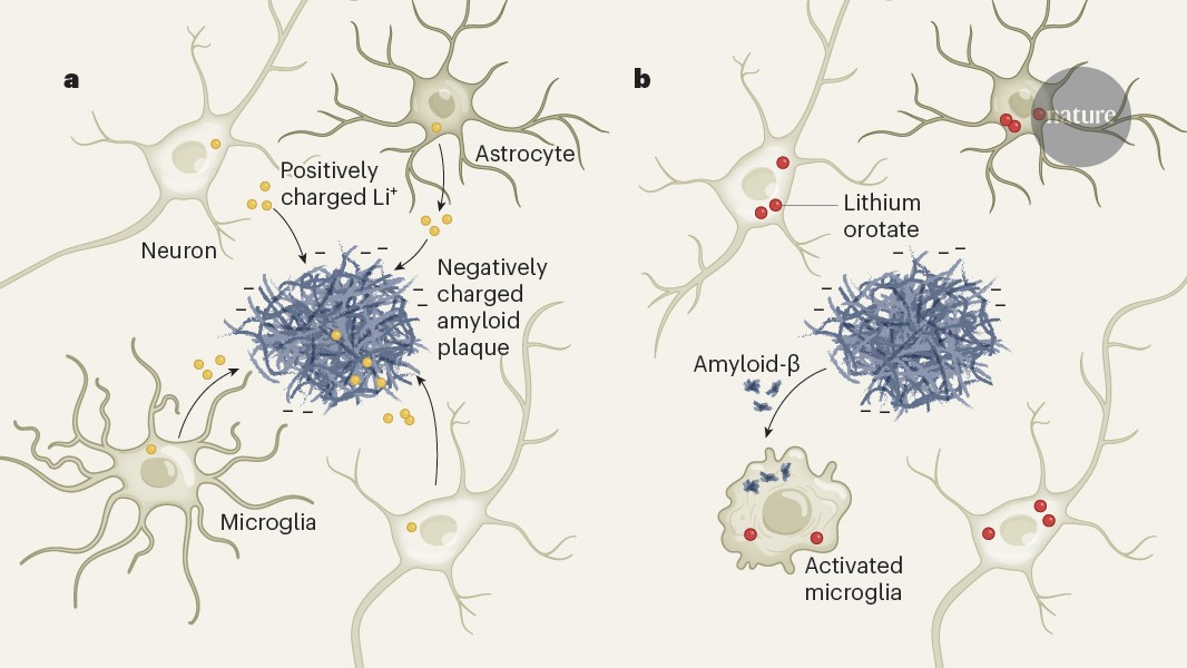 Does lithium deficiency contribute to Alzheimer’s disease?