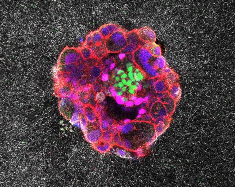 Watch a human embryo implant itself — with brute force