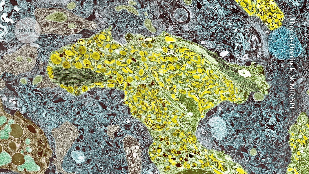 Human brain organoids reveal new path for Alzheimer’s drugs