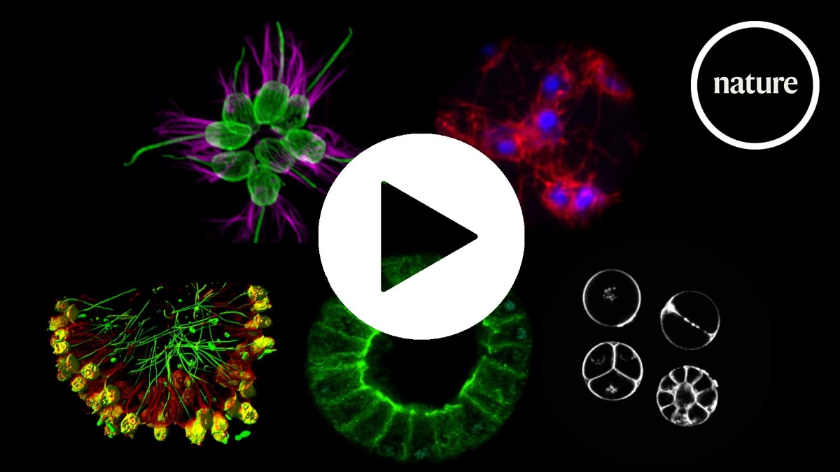 Five single-celled species that dabble in multicellularity