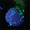 Smart RNA nanodevices reprogram themselves to silence genes in cancer cells