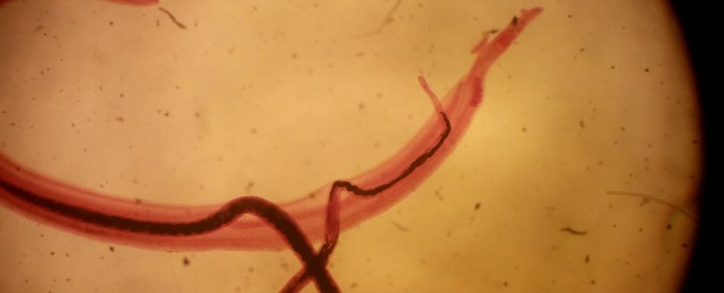 This Parasitic Worm Can Turn Off Your Ability to Feel Pain : ScienceAlert