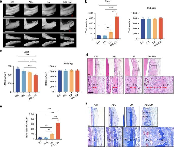 Local abaloparatide administration promotes in situ alveolar bone augmentation via FAK-mediated periosteal osteogenesis