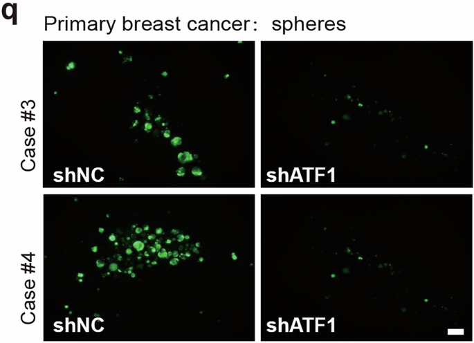 Correction: Cancer cell employs a microenvironmental neural signal trans-activating nucleus-mitochondria coordination to acquire stemness