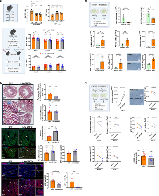 A longevity-associated variant of the human BPIFB4 gene prevents diastolic dysfunction in progeria mice
