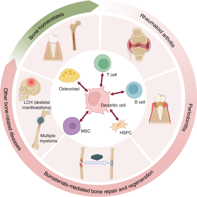 Unraveling the mechanisms of bone diseases: targeting dendritic cells in osteoimmunology for internal homeostasis balance