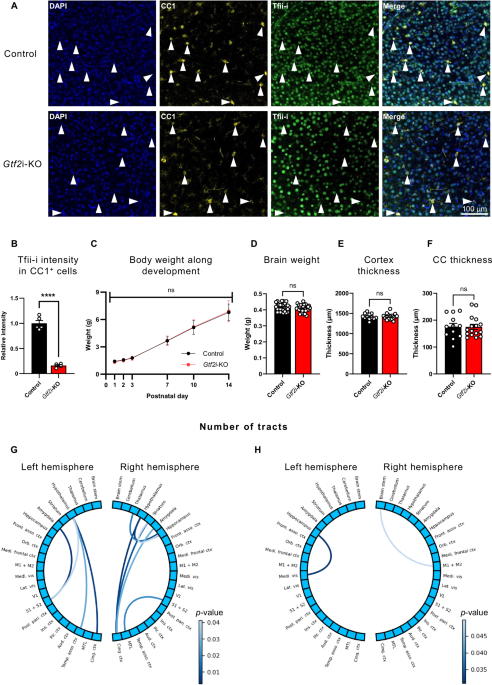 Gtf2i-encoded transcription factor Tfii-i regulates myelination via Sox10 and Mbp regulatory elements