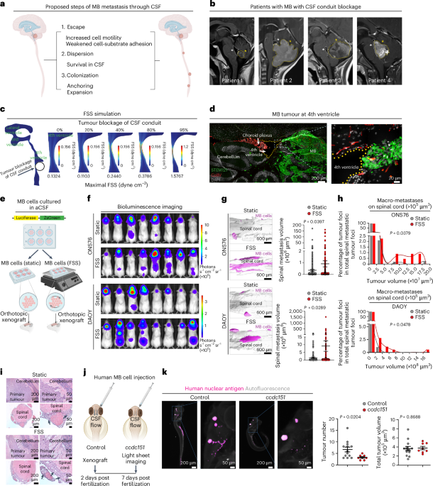 Fluid shear stress activates a targetable mechano-metastatic cascade to promote medulloblastoma metastasis
