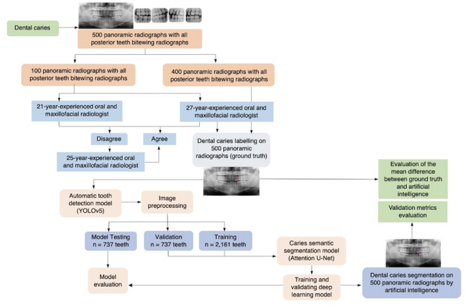 Clinical application of deep learning for enhanced multistage caries detection in panoramic radiographs