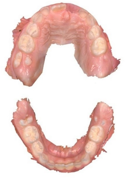 Comparison of dental findings between dentists and pediatricians using intraoral scan-based teledentistry in children