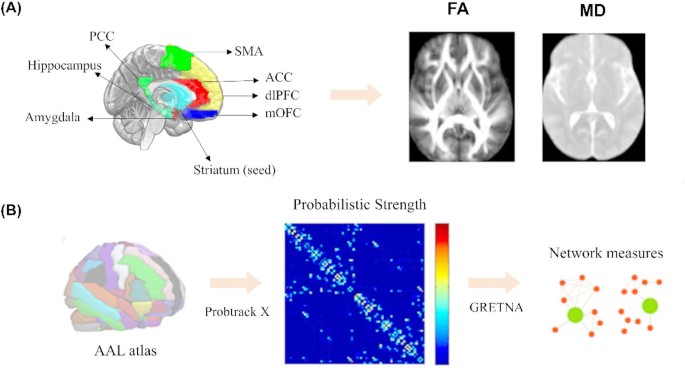 White matter neural substrates in alcohol dependence with genetic risk and their role in pathological reward process