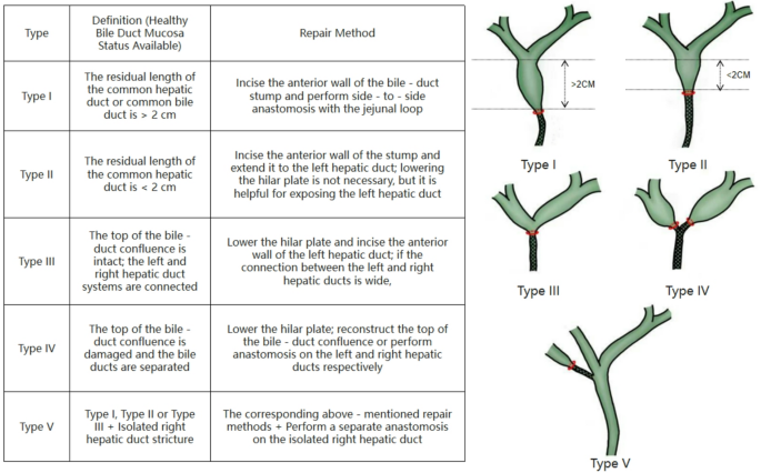 Repeated laparoscopic Roux-en-Y hepaticojejunostomy techniques and pitfalls to watch out with video