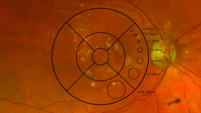 Evaluating the clinical utility of multimodal large language models for detecting age-related macular degeneration from retinal imaging