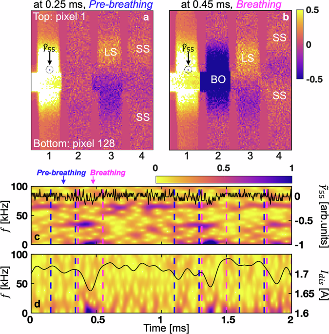 Dynamic three-wave coupling between local sporadic spokes and emergence of global breathing oscillation in partially magnetized cross-field plasmas