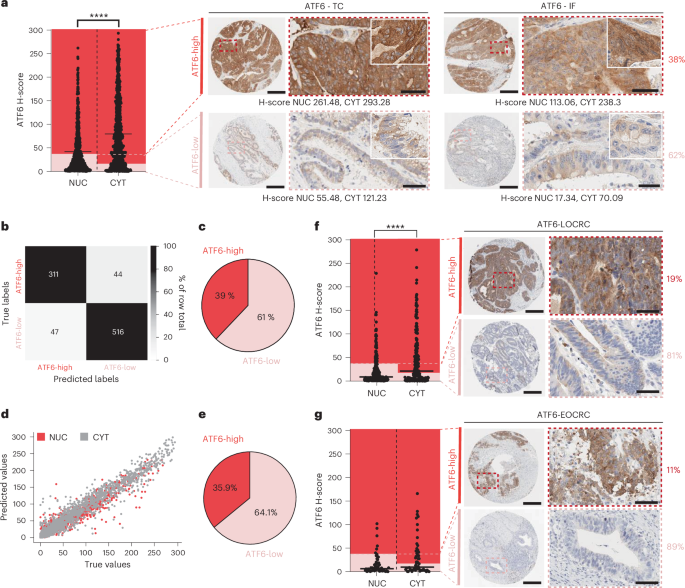 ATF6 activation alters colonic lipid metabolism causing tumour-associated microbial adaptation
